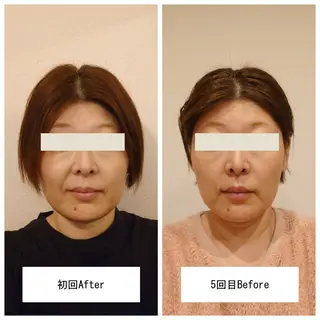 晴れ晴れ 整体院のエステ・リラクイメージ