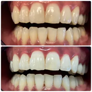 PLATINUM Beauty 横浜店所属・ホワイトニングルーム 横浜店のその他イメージ