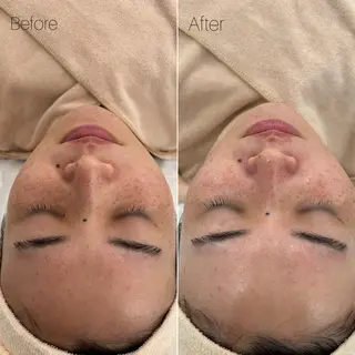 〈etre〉トータルビューティーサロン所属・etre - 韓国肌管理 -のエステ・リラクイメージ