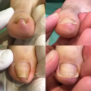 ネイル 東京巻き爪アカデミー所属・東京巻き爪 アカデミーのエステ・リラクイメージ