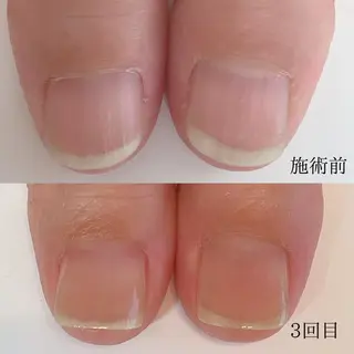 木村 千晴のネイルデザイン