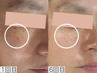 WHITE AQUA 北千住店のエステ・リラクイメージ