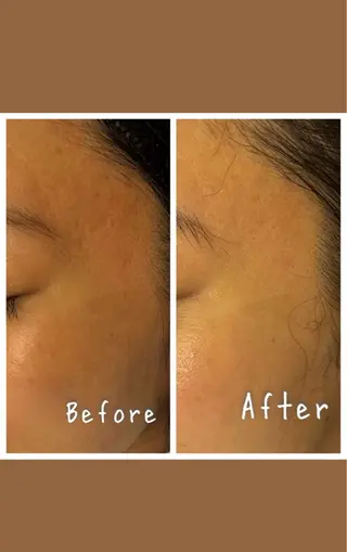 看護師が施術する 美容サロン/元治のエステ・リラクイメージ