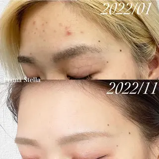 Liber Kyoto所属・魔法のシミ取り職人 CHIKAのマツエク・マツパデザイン