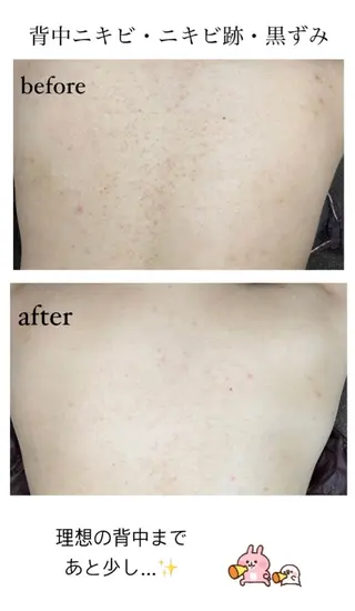 ベラージュ【美背中・ 美尻・フェイシャル】のエステ・リラクイメージ