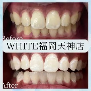 メンズ ホワイトニング専門店 WHITE天神店のエステ・リラクイメージ