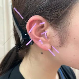 小林整骨院玉川 キジマのエステ・リラクイメージ