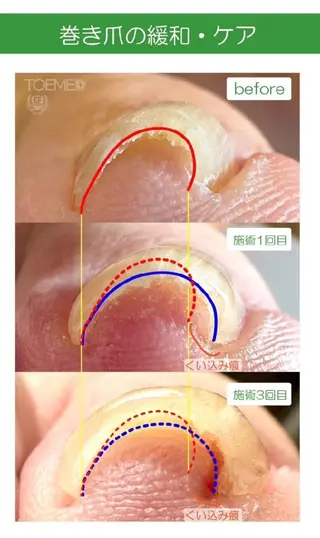 ネイル 本村 れいみのネイルデザイン