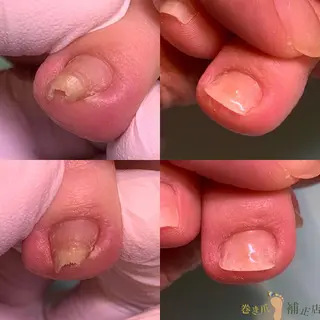 ネイル 東京巻き爪アカデミー所属・東京巻き爪 アカデミーのエステ・リラクイメージ