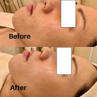 POLA NATURUのエステ・リラクイメージ