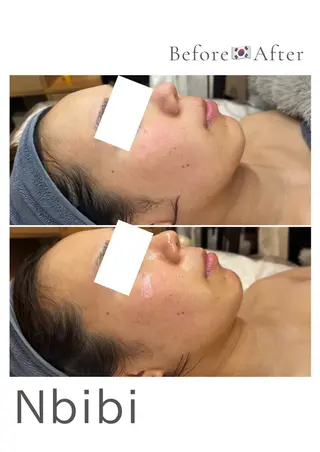 韓国🇰🇷価格 サロン_Nbibiのエステ・リラクイメージ