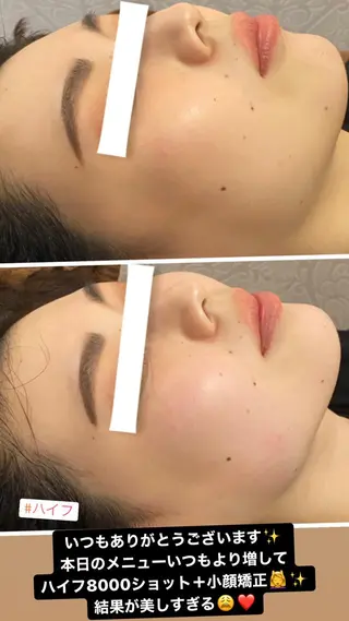 FLEUR大阪・整体 ・ハイフ・痩身・小顔のエステ・リラクイメージ