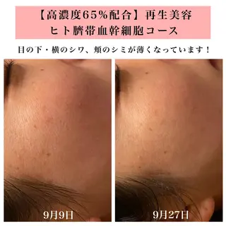 Bellesthe (ベルエステ)のエステ・リラクイメージ