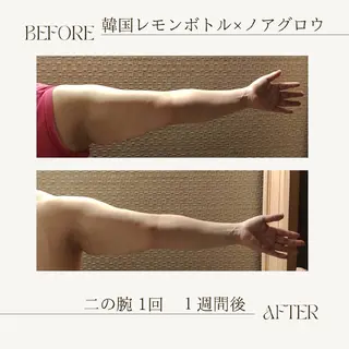 痩身小顔専門 アマテ ビューティー.Nのエステ・リラクイメージ