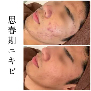 ハーブピーリング専門 BIOEL横浜のエステ・リラクイメージ