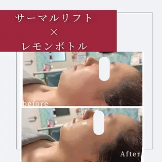 小顔矯正専門店 ❤️池田 桃花のエステ・リラクイメージ