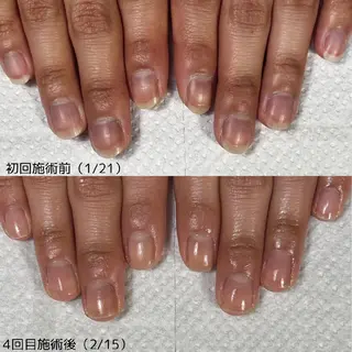 ネイル nail 1623のネイルデザイン