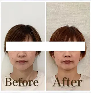 小顔と ヘッドスパのお店のエステ・リラクイメージ