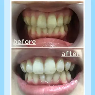 メンズ お手軽ホワイトニングsalon mina所属・武元 奈津美のその他イメージ