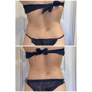 毛穴洗浄・痩身・脱毛 /アルカンジュのエステ・リラクイメージ