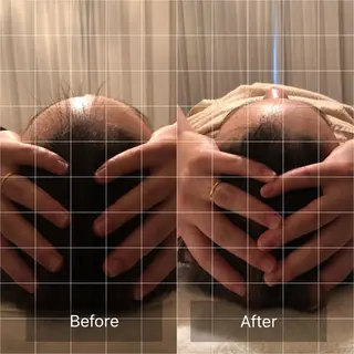 OfuSalon PARAFUSE.のエステ・リラクイメージ