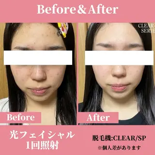 有人型セルフサロン 脱毛/痩身/美顔のその他イメージ