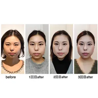 ショート カラー ヘアアレンジ ネイル マツエク・マツパ 小顔矯正専門サロンジュマリ所属・町田 淳子のエステ・リラクイメージ