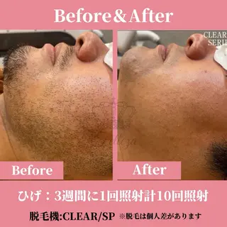 メンズ 有人型セルフサロン 脱毛/痩身/美顔のその他イメージ