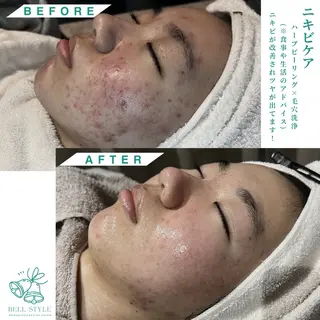 メンズ キッズ メンズ&レディース　Bell style所属・【脱毛・美肌専門】 bellstyleのエステ・リラクイメージ