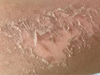 ☺ハーブピール💕 ソフィアカロン💖のエステ・リラクイメージ