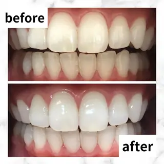 LBSホワイトニング 🌐渋谷店 河内のエステ・リラクイメージ