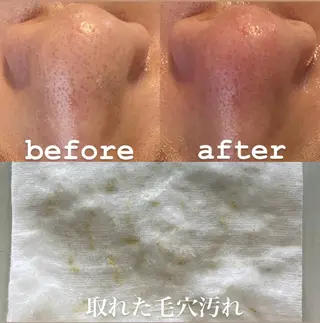 クレアス勝どき・肌質改善専門店【CREAS Beauty Salon】所属・クレアス勝どき【毛穴 ハーブピーリング専門のエステ・リラクイメージ