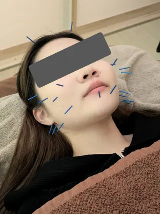 かえるのサロン所属・函南の美容鍼灸アロマ かえるのサロン🐸のエステ・リラクイメージ