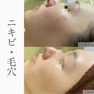 ハーブピーリング専門 BIOEL横浜のエステ・リラクイメージ