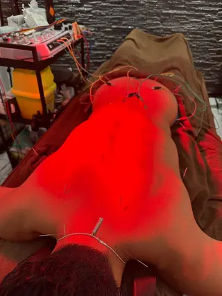 美容鍼灸整体サロンBeauJu所属・小顔矯/美容鍼/鍼灸 BeauJuのその他イメージ