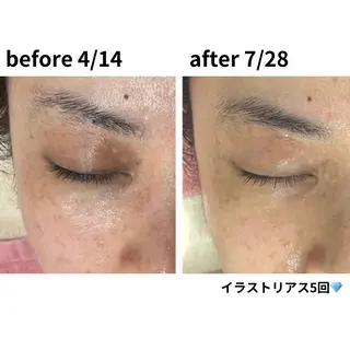 フェイシャル/脱毛 ジョアアンジェ竹田のエステ・リラクイメージ