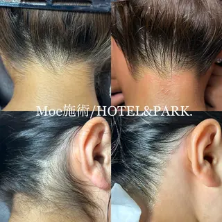 HOTEL&PARK .Moeワックス脱毛のエステ・リラクイメージ