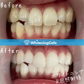 ホワイトニングカフェ神戸元町店所属・ホワイトニングカフェ 神戸元町店のエステ・リラクイメージ