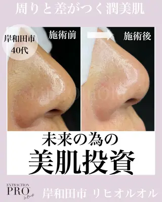 毛穴汚れ改善専門店/ 岸和田/リヒオルオルのエステ・リラクイメージ