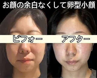 小顔専門看護師クリニカルサロンCOCO所属・ローマピンクと小顔 クリニカルサロンココのエステ・リラクイメージ