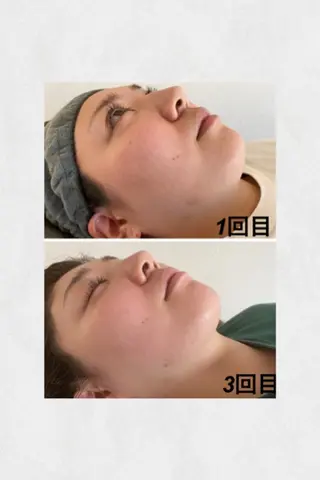 松山 碧のエステ・リラクイメージ