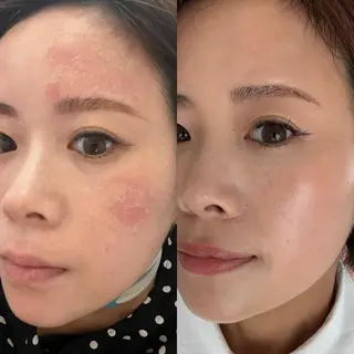 【vidyto】ヴィディトゥ所属・肌管理サロン vidyto　MOEのその他イメージ