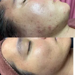 ニキビ、痩身、脱毛、 サクラチャンスパのエステ・リラクイメージ