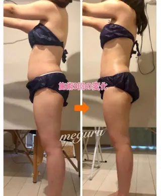 ショート カラー パーマ ヘアアレンジ メンズ キッズ ネイル マツエク・マツパ 痩身&ボディ 結果出し🌟丹野のエステ・リラクイメージ