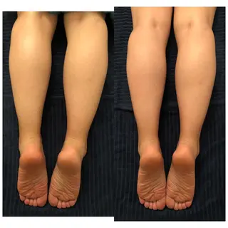 おうちサロン B-ROOMのエステ・リラクイメージ