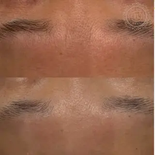 べアール所属・小顔/毛穴/白玉肌 salon bealのその他イメージ