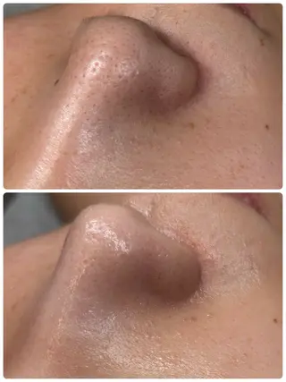 メンズ Salon【yuzu.】所属・肌管理×美眉 【yuzu.】のその他イメージ