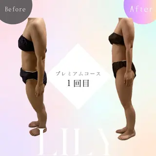 温活痩身サロン ヨサパークリリーのエステ・リラクイメージ