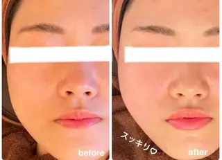 ■超絶小顔&肌管理室■所属・🦋整形級の究極美顔 本格韓国式小顔🦋のエステ・リラクイメージ