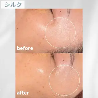 🫧ビュースタ 伊藤🫧のエステ・リラクイメージ